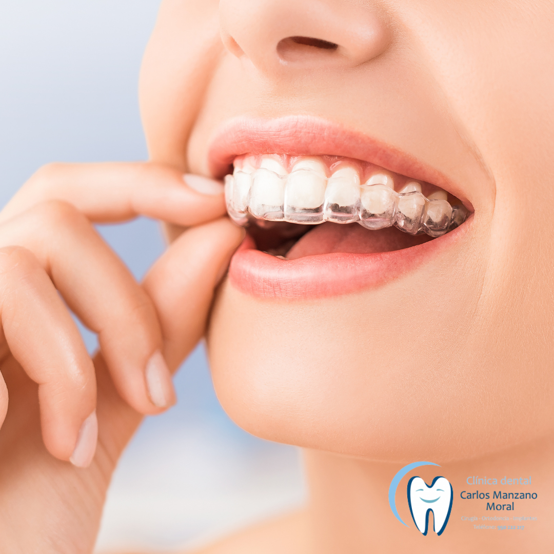 Clínica Dental Carlos Manzano Moral - Clínica dental en Almería