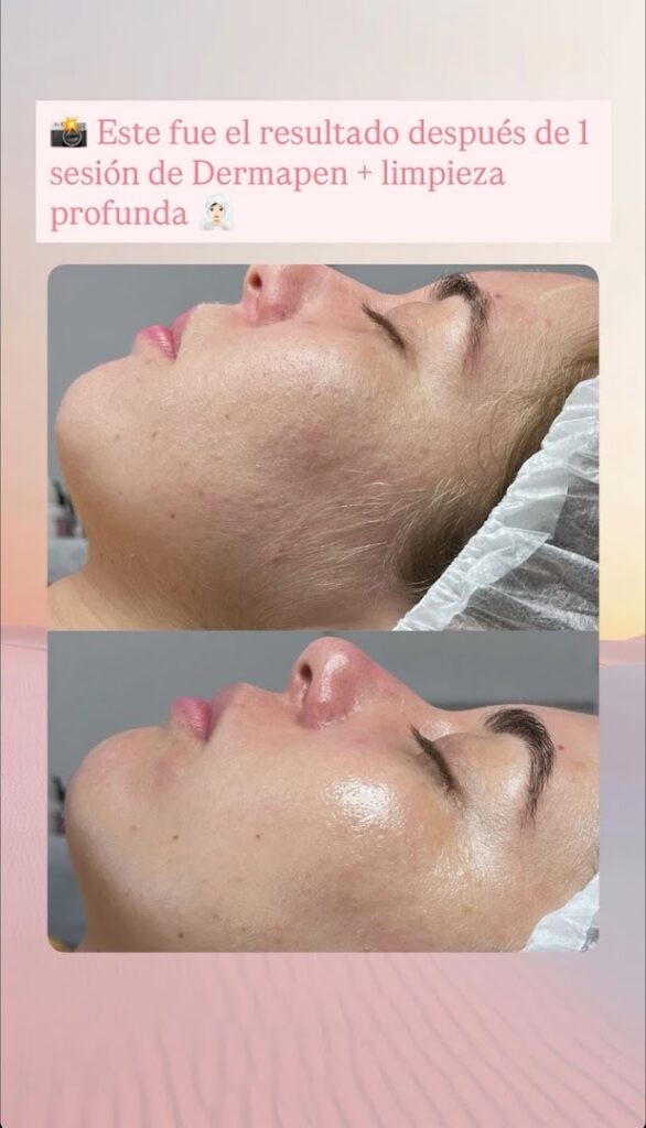 Glow&Relax - Esteticista facial en Almería