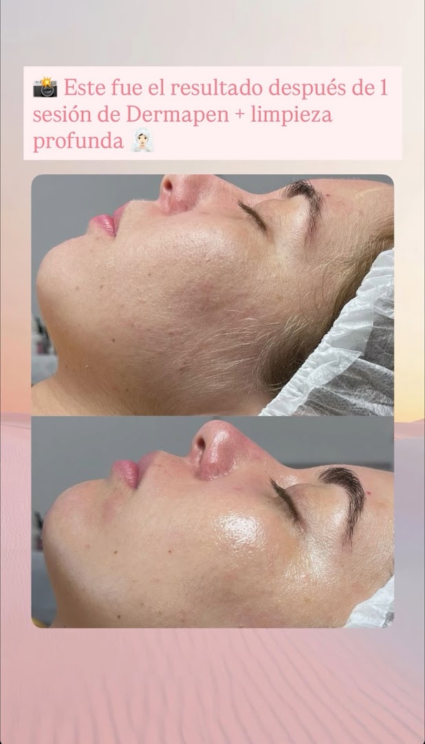 Glow&Relax - Esteticista facial en Almería