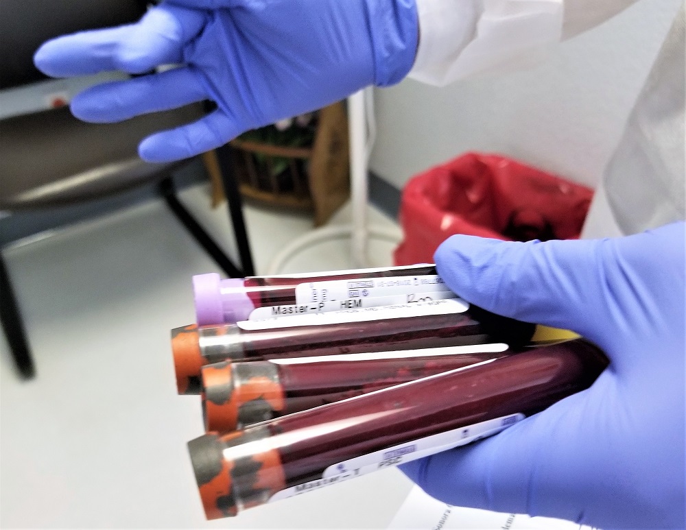 Hematologo Almeria - Interpretar Analisis de Sangre Online - Alteraciones Analiticas - Hematólogo en Almería
