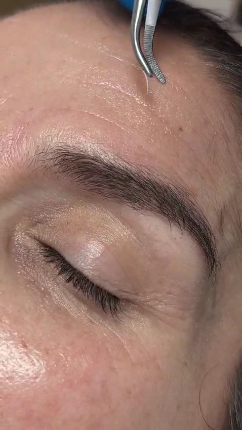Miriam Perellon Estética avanzada - Esteticista facial en Almería