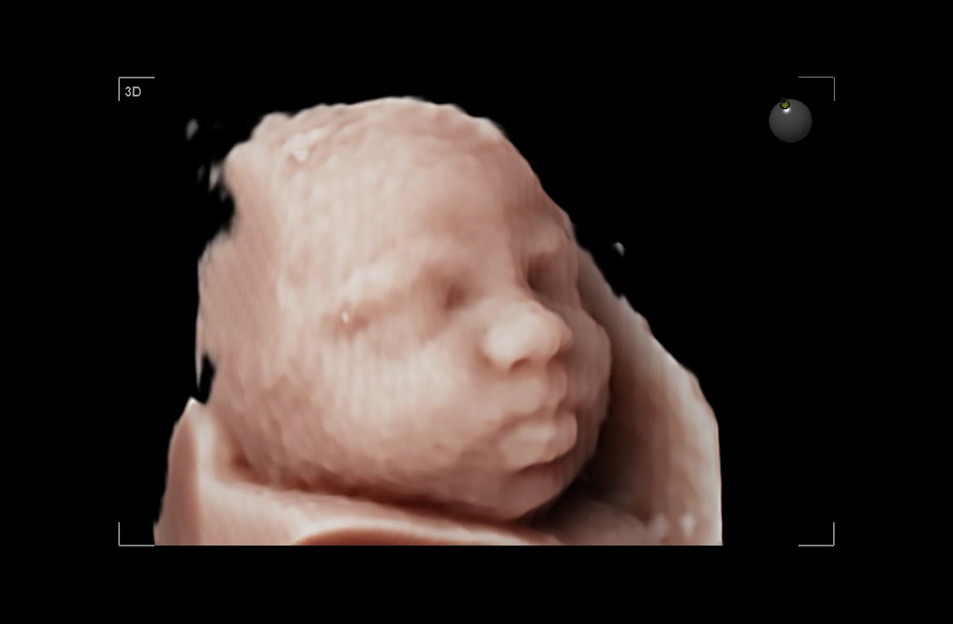 Natal Matronas - Ecografía 5D/6D - Preparación al Nacimiento - Centro médico en Almería